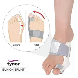 shree Tynor Bunion Splint- Universal size Splints image 3