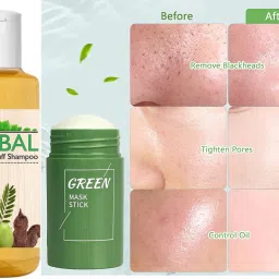 Av-989 Face Shaping Mask-image-76