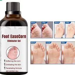 ayyiashi Foot Corn Remover Serum 30ml Easy Apply Therapy Unisex Fast Acting Relief-picture-38