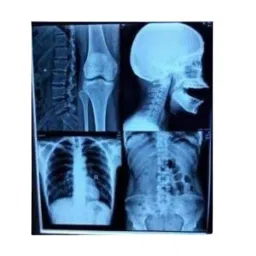 Spox 8x10 inch 280 GSM Pet Inkjet Blue Medical Imaging Film (Pack of 100)-image-40