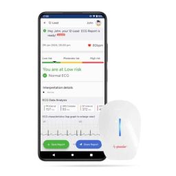 Sunfox Spandan ECG 4.0 ABS White Portable ECG Heart Rate Monitor with Li-ion Battery &a; 20 Pcs ECG Electrodes, X2-OM8E-U3FQ-29