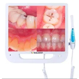Waldent Intraoral TV Model-30