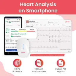 Sunfox Spandan ECG 4.0 Plastic &a; ABS White 12 Leads Portable ECG Machine for Home (Pack of 2) image 2