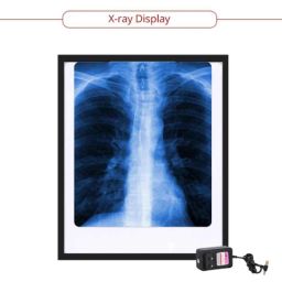 Paxmax 12V Single Film LED X Ray Illuminator View Box with Variable Brightness Control, EC-2 image 2