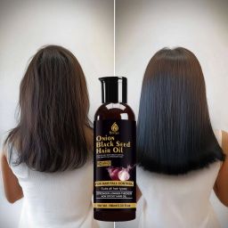 Red Onion Hair Oil 100ml – A Herbal Remedy for Hair Fall Hair Oil-image-34