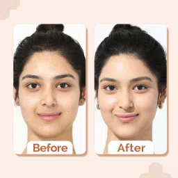 the derma co 2% Niacinamide High Coverage Foundation with 1% Hyaluronic Acid & SPF 40 PA+++ Foundation image 5