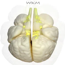 wkm 3D Human Brain Model Structure Life Size Anatomy Removable in 3 Parts image 2