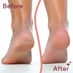 bholu foot exfoliator with variable speed image 5