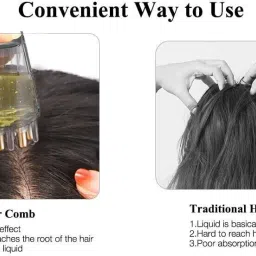 ntz Hair Oil Applicator Comb, Smooth Root Comb Applicator Bottle For Scalp Oil, image 3