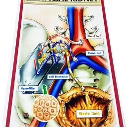 melody's Artificial Kidney Biology Working Science Project Model. image 2