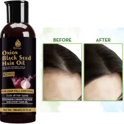 Unlock Thicker Hair with Red Onion Hair Oil 100ml Hair Oil-image-3