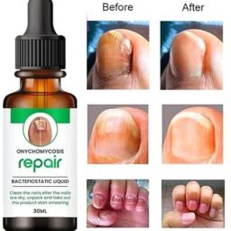 Nail Repair Serum Helps Strengthen breaking nails malticolur Men & Women 300 ml-image-74