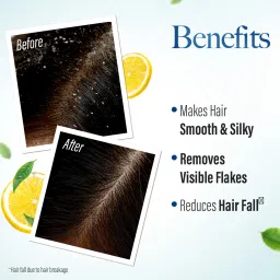 kesh king Ayurvedic Anti-Dandruff Shampoo| Soothes itchy scalp | 21 herbs, curd & lemon image 5