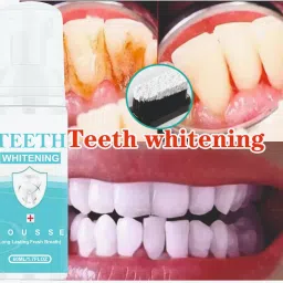 Teeth Whitening foam Make your Teeth White n Sparkle Teeth Whitening Teeth Whitening Kit-1
