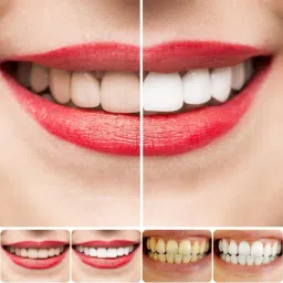 glock Sp 4 Ultra whitening teeth and kill gums Toothpaste0kh (50 g) Toothpaste image 3