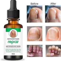 Nail Serum - Boost Nail Growth, Strong and Repair Nails | Cutical Care clear-13