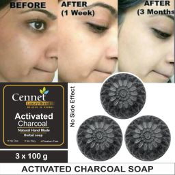 Activated Charcoal Soap For Women Skin Whitening , Pimples, Blackheads , Acne, Natural Detox Face & Body Soap-image-33
