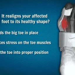 shree Tynor Bunion Splint- Universal size Splints image 5