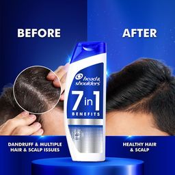 Head & Shoulders 7-in-1 Benefits Anti-Dandruff Shampoo - 650ml image 3