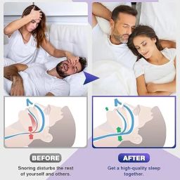K_ML_SN_BC Anti-snoring Device-image-86