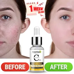NutriOwn Vitamin C Serum for Radiant Skin & Hyper Pigmentation | Instantly Boosts Glow and Gradually Reduces Spots | Bright Complete Professional Vitamin C Booster image 3
