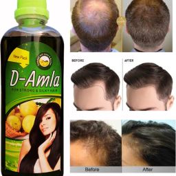 D AMLA Oil for Hair Regrowth Aryuvedic Hair Oil 200ml Hair Oil-image-90