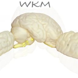 wkm 3D Human Brain Model Structure Life Size Anatomy Removable in 3 Parts image 4