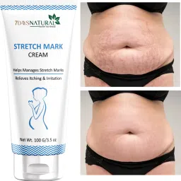 Stretch Marks Removal Cream for Women Men 100% Natural Ayurvedic Cream Intimate Cream-picture-14