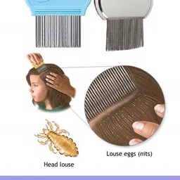 Alexvyan Set Of 2 Metal Teeth Magnifier Lens Nit & Egg Head Lice Comb image 3