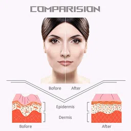 Getmecraft V-Line Lifting & Double Chin Reducer V-Shaped Slimming Face Mask - 50gms image 2