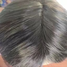 EKO hair patch Black Color (9X7) Fine Human Toupee Patch/ Piece/Wigs For Men Hair Extension-image-27