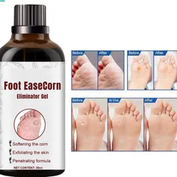 ayyiashi Corn Remover Gel Natural Soft Skin Pack Safe Use-picture-35