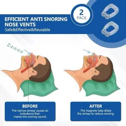 Efficient Anti Snoring Nose Vents Nose Shaper-15