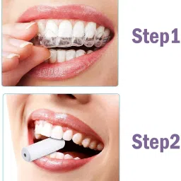 dentosmile Chewies Seater for Invisalign Aligner Chompers Trays in Blue Colour with Carry Case (Unscented) Teeth Whitening Kit image 4