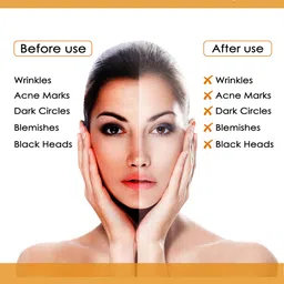NutriGlow Sustainable Sustainable Papaya Facial Kit For Blemish Free 250g+10ml with Jade Roller image 3