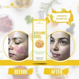 Virgin Sesame Oil- Pure and Natural (100 ml)-image-2