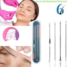 Stainless Steel Blackhead Remover Needle-image-54