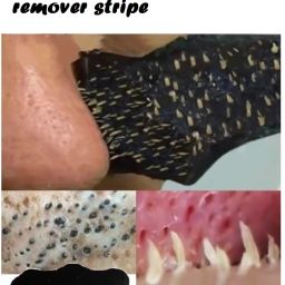 Paper Blackhead Remover Strips-image-25