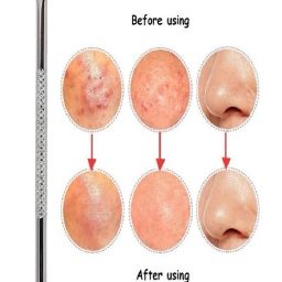 Stainless Steel Blackhead Remover Needle-image-49