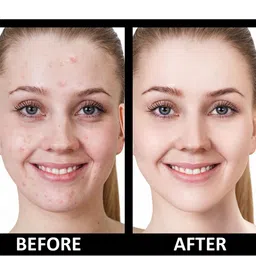 SHRYOAN Hydra-boost High Coverage Foundation 40g image 5