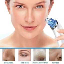 Vibrat Enterprise 4 in 1 Multi-function Blackhead Whitehead Extractor Remover Device - Acne Pimple Pore Cleaner Vacuum Suction Tool For Men And Women image 2