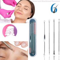 Stainless Steel Blackhead Remover Needle-image-16