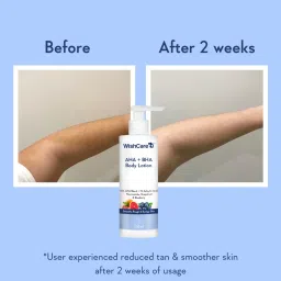 wishcare 10% AHA + 1% BHA Body Lotion - Smooths Rough & Bumpy Skin - With Niacinamide image 3