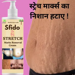 Sfido stretch marks , remover cream for men stretch marks & women-image-89