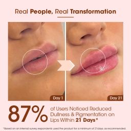 tac - the ayurveda co. Beetroot Lip Butter | SPF 20, Repairs Dry Lips & Reduces Pigmentation | Hydrates Beetroot, Cocoa Butter, Shea Butter image 5
