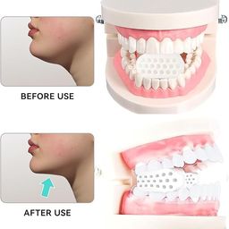 FUPUAII 6PCS Jaw Exerciser, Jaw Exerciser for Men & Women, 3 Resistance Levels, Suitable for Beginners, Intermediate and Advanced Users image 3