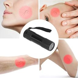 Vein Finder, Red Light, Handheld LED Vein Lamp, Infusion Vein Viewer Locator, for EMTs, Paramedics and Firefighters Performing IV Access on Patients image 4