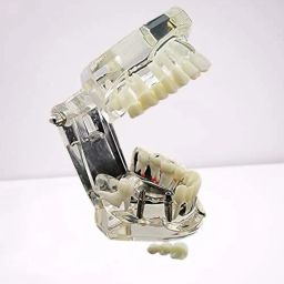 iDENTical Dental All-in-One Study Model | Includes Dental Implants, Crown & Bridge, Root Canal | Implant-Supported Bridge | Tooth Avulsion | Abfraction, Caries & Periapical Study Feature image 3
