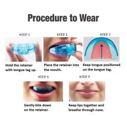 InstruDent U Ortho Blue Retainer - Stage 2 (Medium) image 3