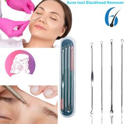 Stainless Steel Blackhead Remover Needle-image-17